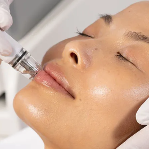 AknoEvit Facial